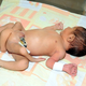Illustration for article titled Pakistani baby born with six legs recovering well, following removal of extra limbs